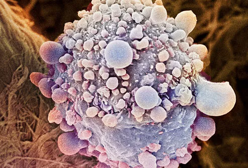 Cancer Cells Diagram