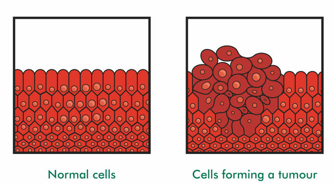 Cancer Cells Diagram